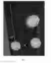 Fig. 07 - Analyte sensors comprising leveling agents