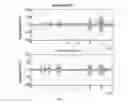 Fig. 03 - Method with biofeedback for training the muscles of the pelvic floor