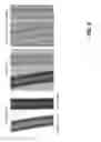 Fig. 10 - Large FOV phase contrast imaging based on detuned configuration including acquisition and reconstruction techniques