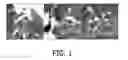 Fig. 02 - Chronic obstructive pulmonary disease (COPD) phantom for computed tomography (CT) and methods of using the same