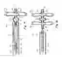 Fig. 06 - Septal closure device with centering mechanism