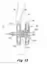 Fig. 07 - Septal closure device with centering mechanism