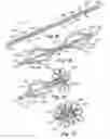 Fig. 08 - Septal closure device with centering mechanism