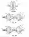 Fig. 09 - Septal closure device with centering mechanism