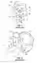 Fig. 02 - Devices and methods for temporarily retaining spinal rootlets within dural sac