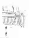 Fig. 49 - Devices and methods for continuous surgical suturing
