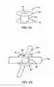 Fig. 07 - Devices and methods for heart valve repair