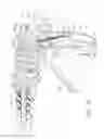 Fig. 07 - Fastener cartridge assembly comprising a fixed anvil