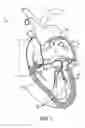 Fig. 02 - INDEPENDENT GRIPPER