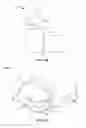 Fig. 07 - Embolization device and a method of using the same