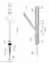Fig. 22 - Percussive surgical devices, systems, and methods of use thereof