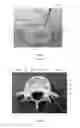 Fig. 02 - Tunneling device
