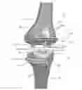 Fig. 01 - Low profile patient specific cutting blocks for a knee joint