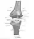 Fig. 02 - Low profile patient specific cutting blocks for a knee joint