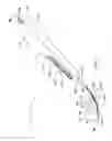 Fig. 02 - Surgical instrument and method of use for releasing soft tissue