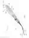 Fig. 04 - Surgical instrument and method of use for releasing soft tissue