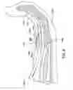 Fig. 08 - Surgical instrument and method of use for releasing soft tissue