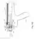 Fig. 32 - Loading features for ultrasonic surgical instrument