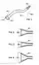 Fig. 03 - Foreign object extractor