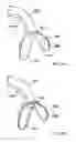 Fig. 09 - Foreign object extractor