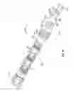 Fig. 09 - Derotation apparatus for treating spinal irregularities