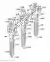 Fig. 01 - Dynamic fixation assemblies with inner core and outer coil-like member
