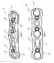Fig. 02 - Vertical inline plate