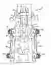 Fig. 01 - Spinal stabilization system