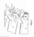 Fig. 07 - Spinal stabilization system