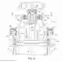 Fig. 33 - Spinal stabilization system