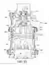 Fig. 35 - Spinal stabilization system