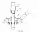 Fig. 40 - Spinal stabilization system