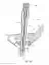 Fig. 41 - Spinal stabilization system