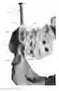 Fig. 01 - Systems and methods for fusing a sacroiliac joint and anchoring an orthopedic appliance