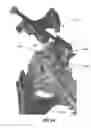 Fig. 137 - Systems and methods for fusing a sacroiliac joint and anchoring an orthopedic appliance