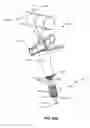 Fig. 147 - Systems and methods for fusing a sacroiliac joint and anchoring an orthopedic appliance