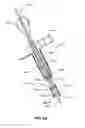 Fig. 149 - Systems and methods for fusing a sacroiliac joint and anchoring an orthopedic appliance