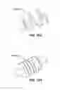 Fig. 28 - Systems and methods for fusing a sacroiliac joint and anchoring an orthopedic appliance