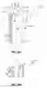 Fig. 47 - Systems and methods for fusing a sacroiliac joint and anchoring an orthopedic appliance