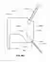 Fig. 77 - Systems and methods for fusing a sacroiliac joint and anchoring an orthopedic appliance