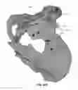 Fig. 79 - Systems and methods for fusing a sacroiliac joint and anchoring an orthopedic appliance