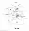Fig. 89 - Systems and methods for fusing a sacroiliac joint and anchoring an orthopedic appliance