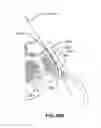 Fig. 99 - Systems and methods for fusing a sacroiliac joint and anchoring an orthopedic appliance