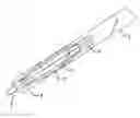 Fig. 01 - Electrode geometries and method for applying electric field treatment to parts of the body