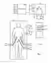 Fig. 02 - Non-force reflecting method for providing tool force information to a user of a telesurgical system