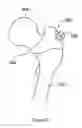 Fig. 05 - Computer-assisted joint replacement surgery and patient-specific jig systems