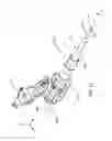 Fig. 46 - Method for repairing focal defects in tissue of a patient