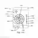 Fig. 76 - Method for repairing focal defects in tissue of a patient