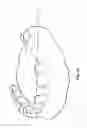 Fig. 02 - Guided drill, kit of guided drills and methods of osteotomy for inserting a dental implant using the kit