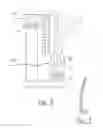 Fig. 06 - Intraoral device for automated preparation of the teeth with a view to performing partial or peripheral restorations